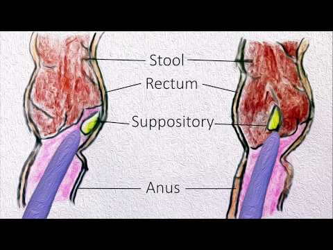 Rectal Suppositories - How to use them?