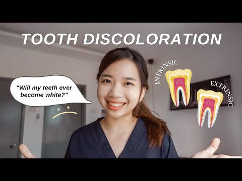 Why are my teeth yellow? I brush everyday! // Dentist Answers