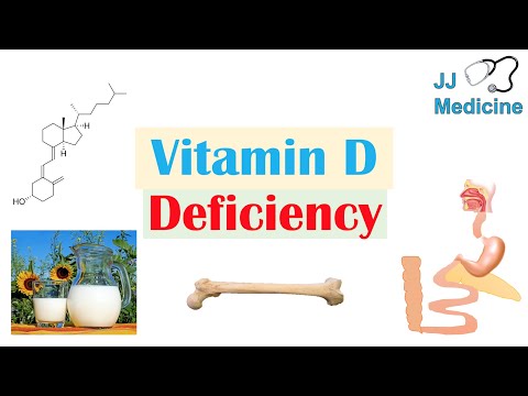 Vitamin D Deficiency | Absorption & Metabolism, Purpose of Vit D, Causes of Deficiency