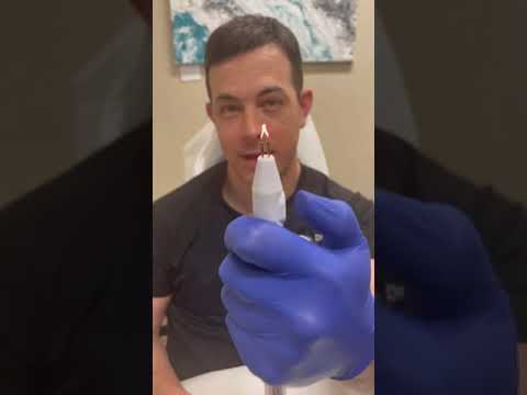 Doctor puts a hole in his own nail! Immediate Relief | 208SkinDoc